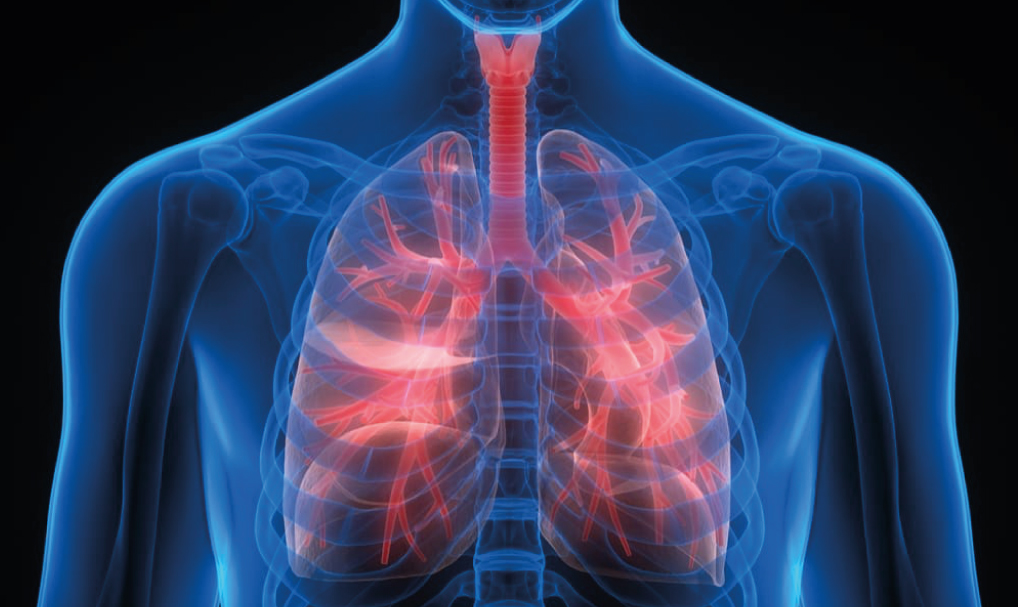 Health priority plan: Occupational lung disease